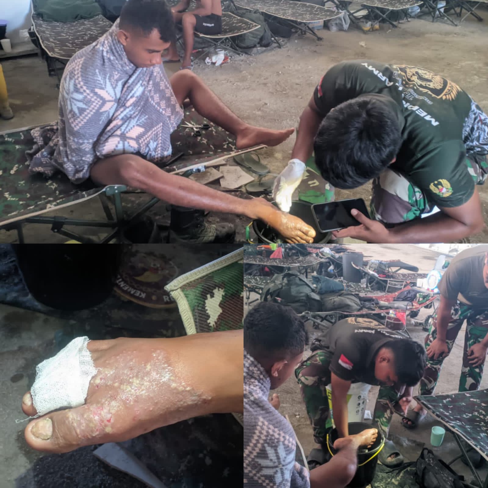 Tenaga Kesehatan TMMD Tangani Personel yang Mengalami Iritasi Semen
