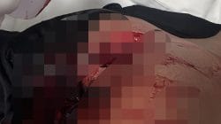 Empat Anggota Brimob Ditikam di Labuan Bajo, Oknum TNI Diduga Jadi Pelaku