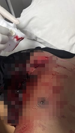 Empat Anggota Brimob Ditikam di Labuan Bajo, Oknum TNI Diduga Jadi Pelaku